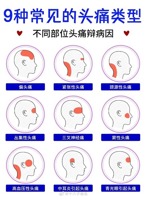 头疼|偏头痛、紧张性头痛、高血压性头痛……一文教你鉴别10种头痛